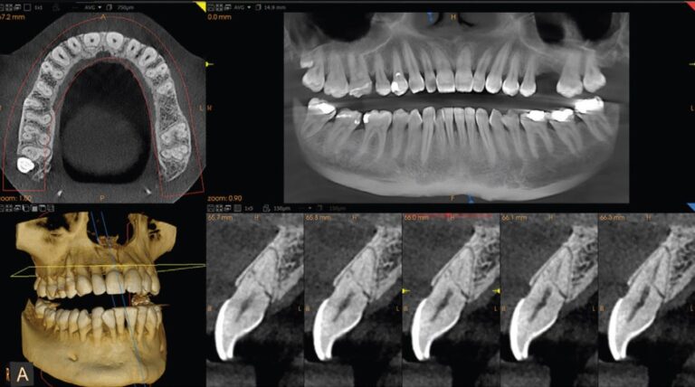 سي تي طوباس